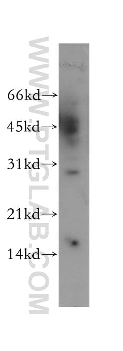 YIPF5 Rabbit anti-Human, Mouse, Rat, Polyclonal, Proteintech:Antibodies:Primary