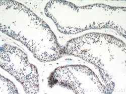 RASGAP Rabbit anti-Human, Mouse, Rat, Polyclonal, Proteintech:Antibodies:Primary