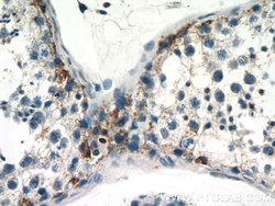 RASGAP Rabbit anti-Human, Mouse, Rat, Polyclonal, Proteintech:Antibodies:Primary