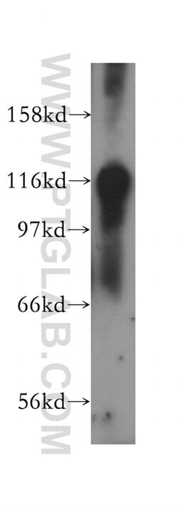 RASGAP Rabbit anti-Human, Mouse, Rat, Polyclonal, Proteintech:Antibodies:Primary
