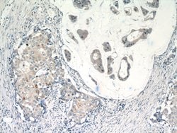 RASGAP Rabbit anti-Human, Mouse, Rat, Polyclonal, Proteintech:Antibodies:Primary