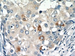 RASGAP Rabbit anti-Human, Mouse, Rat, Polyclonal, Proteintech:Antibodies:Primary