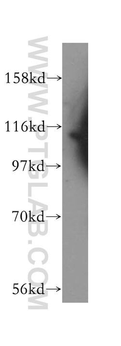 RASGAP Rabbit anti-Human, Mouse, Rat, Polyclonal, Proteintech:Antibodies:Primary