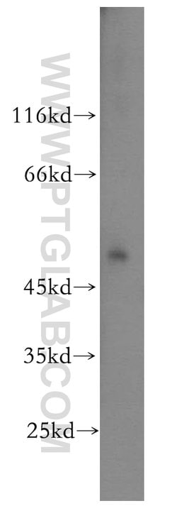 IFRD1 Rabbit anti-Human, Mouse, Rat, Polyclonal, Proteintech:Antibodies:Primary