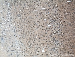 CLASP2 Rabbit anti-Human, Mouse, Polyclonal, Proteintech 150 &mu;L; Unconjugated:Antibodies,