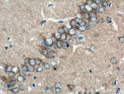 CLASP2 Rabbit anti-Human, Mouse, Polyclonal, Proteintech 150 &mu;L; Unconjugated:Antibodies,