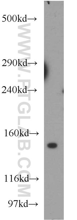 CLASP2 Rabbit anti-Human, Mouse, Polyclonal, Proteintech 150 &mu;L; Unconjugated:Antibodies,