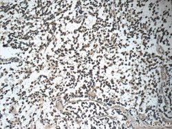 GAGE7 Rabbit anti-Human, Polyclonal, Proteintech:Antibodies:Primary Antibodies