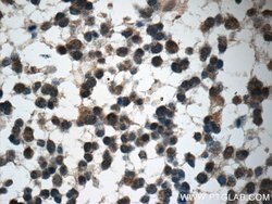 GAGE7 Rabbit anti-Human, Polyclonal, Proteintech:Antibodies:Primary Antibodies