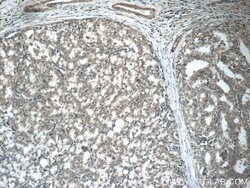 GAGE7 Rabbit anti-Human, Polyclonal, Proteintech:Antibodies:Primary Antibodies