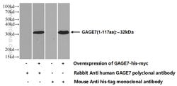 GAGE7 Rabbit anti-Human, Polyclonal, Proteintech:Antibodies:Primary Antibodies