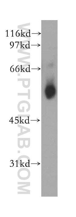VRK2 Rabbit anti-Human, Mouse, Rat, Polyclonal, Proteintech 150 &mu;L;
