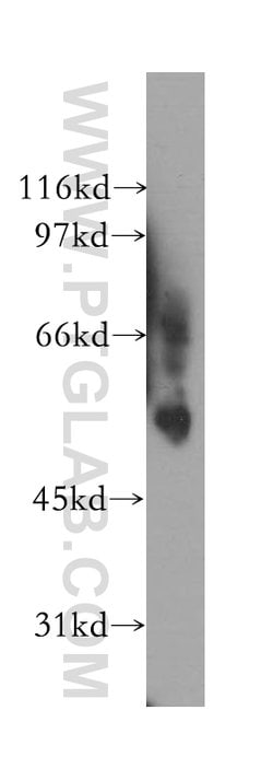 VRK2 Rabbit anti-Human, Mouse, Rat, Polyclonal, Proteintech 150 &mu;L;