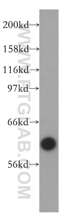 VRK2 Rabbit anti-Human, Mouse, Rat, Polyclonal, Proteintech 150 &mu;L;