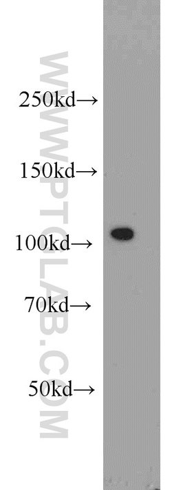 PLK4 Rabbit anti-Human, Mouse, Rat, Polyclonal, Proteintech 150 &mu;L;