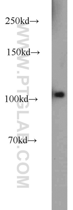 PLK4 Rabbit anti-Human, Mouse, Rat, Polyclonal, Proteintech 150 &mu;L;