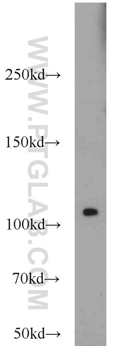 PLK4 Rabbit anti-Human, Mouse, Rat, Polyclonal, Proteintech 150 &mu;L;