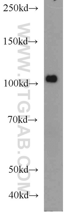 PLK4 Rabbit anti-Human, Mouse, Rat, Polyclonal, Proteintech 150 &mu;L;