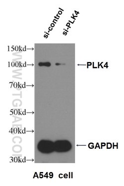 PLK4 Rabbit anti-Human, Mouse, Rat, Polyclonal, Proteintech 150 &mu;L;