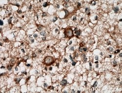CA10 Rabbit anti-Human, Mouse, Rat, Polyclonal, Proteintech 150 &mu;L;