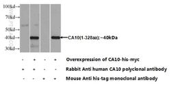 CA10 Rabbit anti-Human, Mouse, Rat, Polyclonal, Proteintech 150 &mu;L;