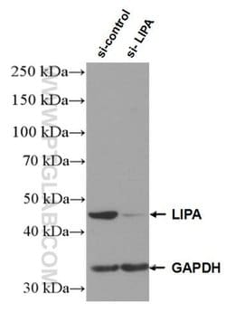 LIPA Rabbit anti-Human, Mouse, Rat, Polyclonal, Proteintech 150 &mu;L;