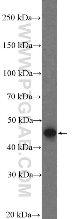 LIPA Rabbit anti-Human, Mouse, Rat, Polyclonal, Proteintech 150 &mu;L;