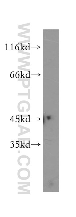LIPA Rabbit anti-Human, Mouse, Rat, Polyclonal, Proteintech 150 &mu;L;