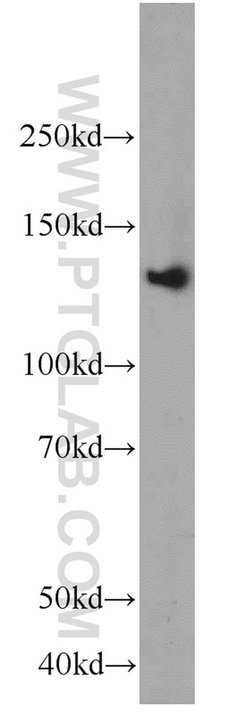 RASGRF1 Rabbit anti-Human, Mouse, Rat, Polyclonal, Proteintech 150 &mu;L;