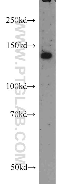 RASGRF1 Rabbit anti-Human, Mouse, Rat, Polyclonal, Proteintech 150 &mu;L;