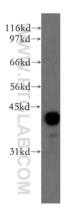 PPM1A Rabbit anti-Human, Mouse, Rat, Polyclonal, Proteintech 150 &mu;L;