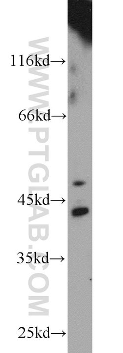 ACP6 Rabbit anti-Human, Mouse, Polyclonal, Proteintech 150 &mu;L; Unconjugated:Antibodies,
