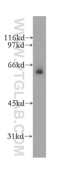 MSL3 Rabbit anti-Human, Mouse, Rat, Polyclonal, Proteintech:Antibodies:Primary