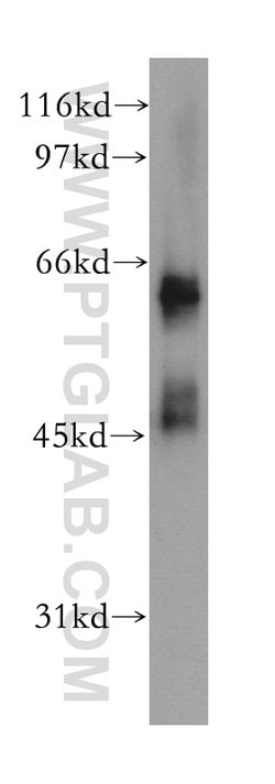 MSL3 Rabbit anti-Human, Mouse, Rat, Polyclonal, Proteintech:Antibodies:Primary