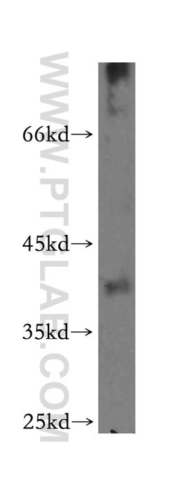 NFYA Rabbit anti-Human, Mouse, Rat, Polyclonal, Proteintech 150 &mu;L;