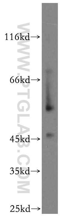 NFYA Rabbit anti-Human, Mouse, Rat, Polyclonal, Proteintech 150 &mu;L;