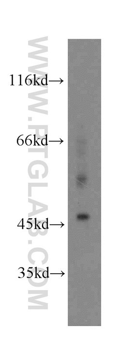 NFYA Rabbit anti-Human, Mouse, Rat, Polyclonal, Proteintech 150 &mu;L;