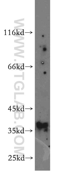 NFYA Rabbit anti-Human, Mouse, Rat, Polyclonal, Proteintech 150 &mu;L;