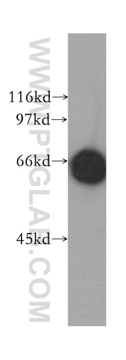 MPP7 Rabbit anti-Human, Mouse, Rat, Polyclonal, Proteintech 150 &mu;L;
