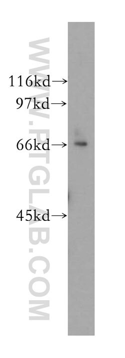 MPP7 Rabbit anti-Human, Mouse, Rat, Polyclonal, Proteintech 150 &mu;L;