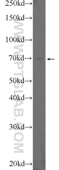 BNIP3L Rabbit anti-Human, Mouse, Rat, Polyclonal, Proteintech 150 &mu;L | Buy Online | Proteintech Group Inc | Fisher Scientific