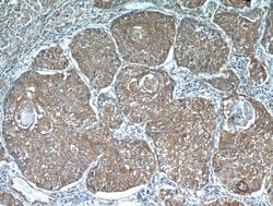 PGRMC1 Rabbit anti-Human, Mouse, Rat, Polyclonal, Proteintech:Antibodies:Primary