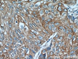 PGRMC1 Rabbit anti-Human, Mouse, Rat, Polyclonal, Proteintech:Antibodies:Primary