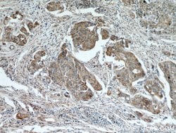 PGRMC1 Rabbit anti-Human, Mouse, Rat, Polyclonal, Proteintech:Antibodies:Primary