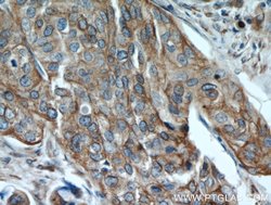 PGRMC1 Rabbit anti-Human, Mouse, Rat, Polyclonal, Proteintech:Antibodies:Primary