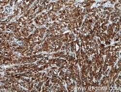 PGRMC1 Rabbit anti-Human, Mouse, Rat, Polyclonal, Proteintech:Antibodies:Primary