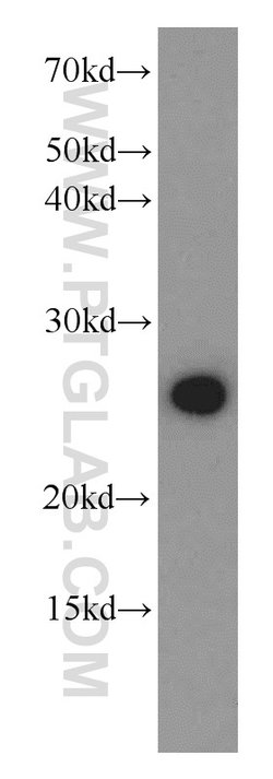 PGRMC1 Rabbit anti-Human, Mouse, Rat, Polyclonal, Proteintech:Antibodies:Primary