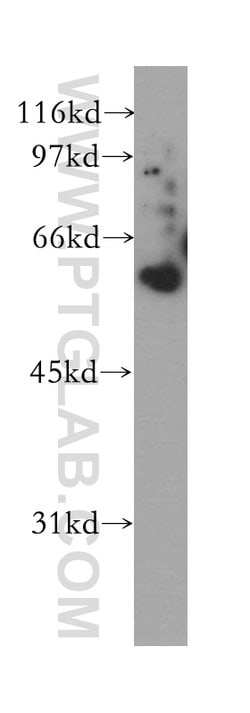 COASY Rabbit anti-Human, Mouse, Rat, Polyclonal, Proteintech 150 &mu;L;