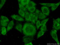 COASY Rabbit anti-Human, Mouse, Rat, Polyclonal, Proteintech 150 &mu;L;