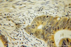 COASY Rabbit anti-Human, Mouse, Rat, Polyclonal, Proteintech 150 &mu;L;